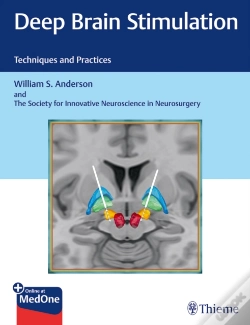 Capa do artigo Deep Brain Stimulation
