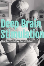 Deep Brain Stimulation - What Are You Getting Yourself In For?