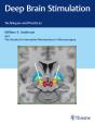 Deep Brain Stimulation - Preview