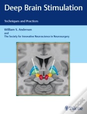 Capa do artigo Deep Brain Stimulation
