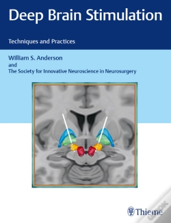Capa do artigo Deep Brain Stimulation