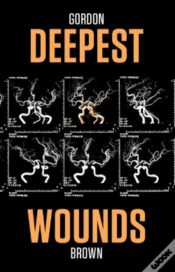 Capa do artigo Deepest Wounds
