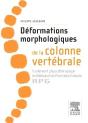 Déformation Morphologique De La Colonne Vertébrale - Preview