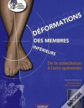 Déformations Des Membres Inférieurs ; De La Consultation À L'Acte Opératoire (Édition 2009)