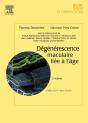 Dégénérescence Maculaire Liée À L'Âge (2e Édition) - Preview