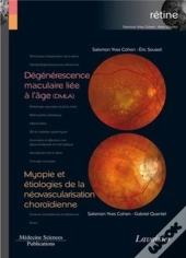 Dégénérescence Maculaire Liée À L'Âge (Dmla) ; Myopie Et Étiologies De La Néovascularisation Choroïdienne