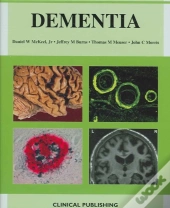 Dementia