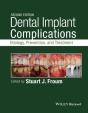 Dental Implant Complications - Preview