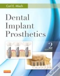Dental Implant Prosthetics