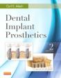 Dental Implant Prosthetics - Preview