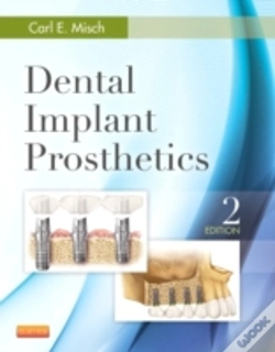 Capa do artigo Dental Implant Prosthetics