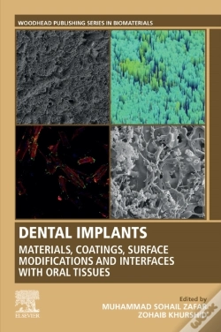 Capa do artigo Dental Implants