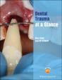 Dental Trauma At A Glance - Preview