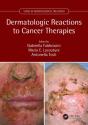 Dermatologic Reactions To Cancer Therapies - Preview