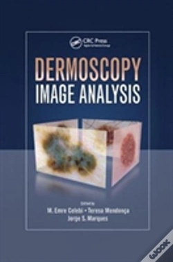 Capa do artigo Dermoscopy Image Analysis
