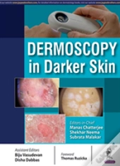 Dermoscopy In Darker Skin