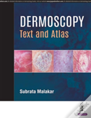 Dermoscopy