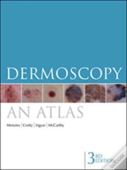 Capa do artigo Dermoscopy