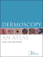 Dermoscopy - Preview