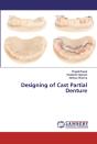 Designing Of Cast Partial Denture - Preview