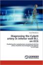 Diagnosing The Culprit Artery In Inferior Wall M.I. On Ecg - Preview