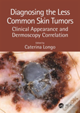 Diagnosing The Less Common Skin Tumors
