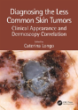 Diagnosing The Less Common Skin Tumors - Preview