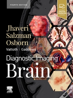 Capa do artigo Diagnostic Imaging: Brain E-Book