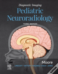 Capa do artigo Diagnostic Imaging: Pediatric Neuroradiology E-Book