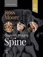 Diagnostic Imaging: Spine - E-Book - Preview
