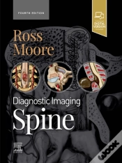 Capa do artigo Diagnostic Imaging: Spine - E-Book