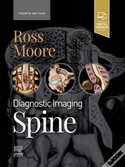 Capa do artigo Diagnostic Imaging: Spine - E-Book
