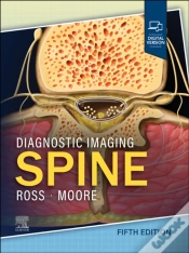 Capa do artigo Diagnostic Imaging: Spine - E-Book