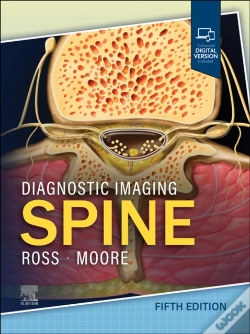 Capa do artigo Diagnostic Imaging: Spine - E-Book