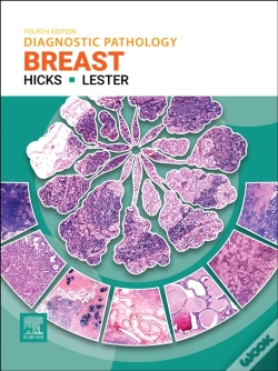 Capa do artigo Diagnostic Pathology: Breast - Ebook