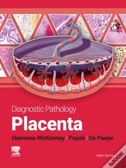 Capa do artigo Diagnostic Pathology: Placenta - E-Book