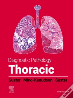 Capa do artigo Diagnostic Pathology: Thoracic - E-Book