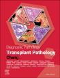 Diagnostic Pathology: Transplant Pathology - E-Book - Preview