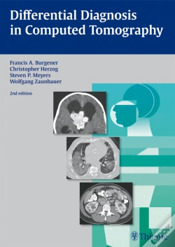 Capa do artigo Differential Diagnosis In Computed Tomography