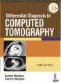 Differential Diagnosis In Computed Tomography - Preview