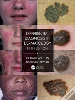 Capa do artigo Differential Diagnosis In Dermatology
