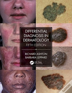 Capa do artigo Differential Diagnosis In Dermatology