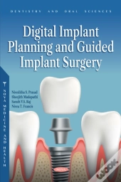 Digital Implant Planning And Guided Implant Surgery
