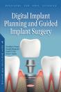 Digital Implant Planning And Guided Implant Surgery - Preview