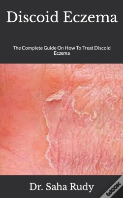 Capa do artigo Discoid Eczema