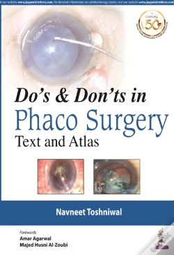 Capa do artigo Do'S & Dont'S In Phaco Surgery