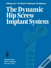 Capa do artigo Dynamic Hip Screw Implant System