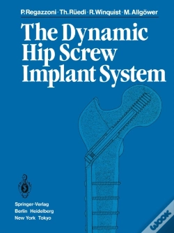 Capa do artigo Dynamic Hip Screw Implant System