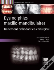 Capa do artigo Dysmorphies Maxillo-Mandibulaires ; Traitement Orthodontico-Chirurgical
