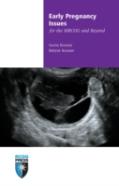 Early Pregnancy Issues For The Mrcog And Beyond